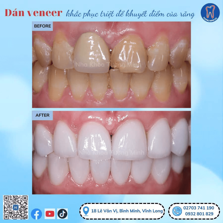 https://lh7-us.googleusercontent.com/g2JIVZ4mwrcm8faci6ocelOkpU_zgk1XQsXu9gCvh8YUNY78HPku91OXhez6_cwtG6ToRptI2fwr9gByFnHIMLw6bAjCMngzRD1KyZIQnilL-7do1KbnO5649auf3t--Mz-2doBwHlGzmEVjRi2lU1o